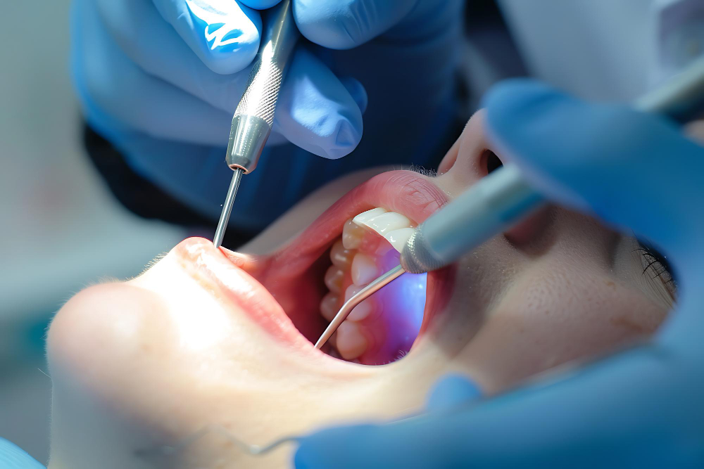 Cum recunoști semnele care indică necesitatea unui tratament endodontic